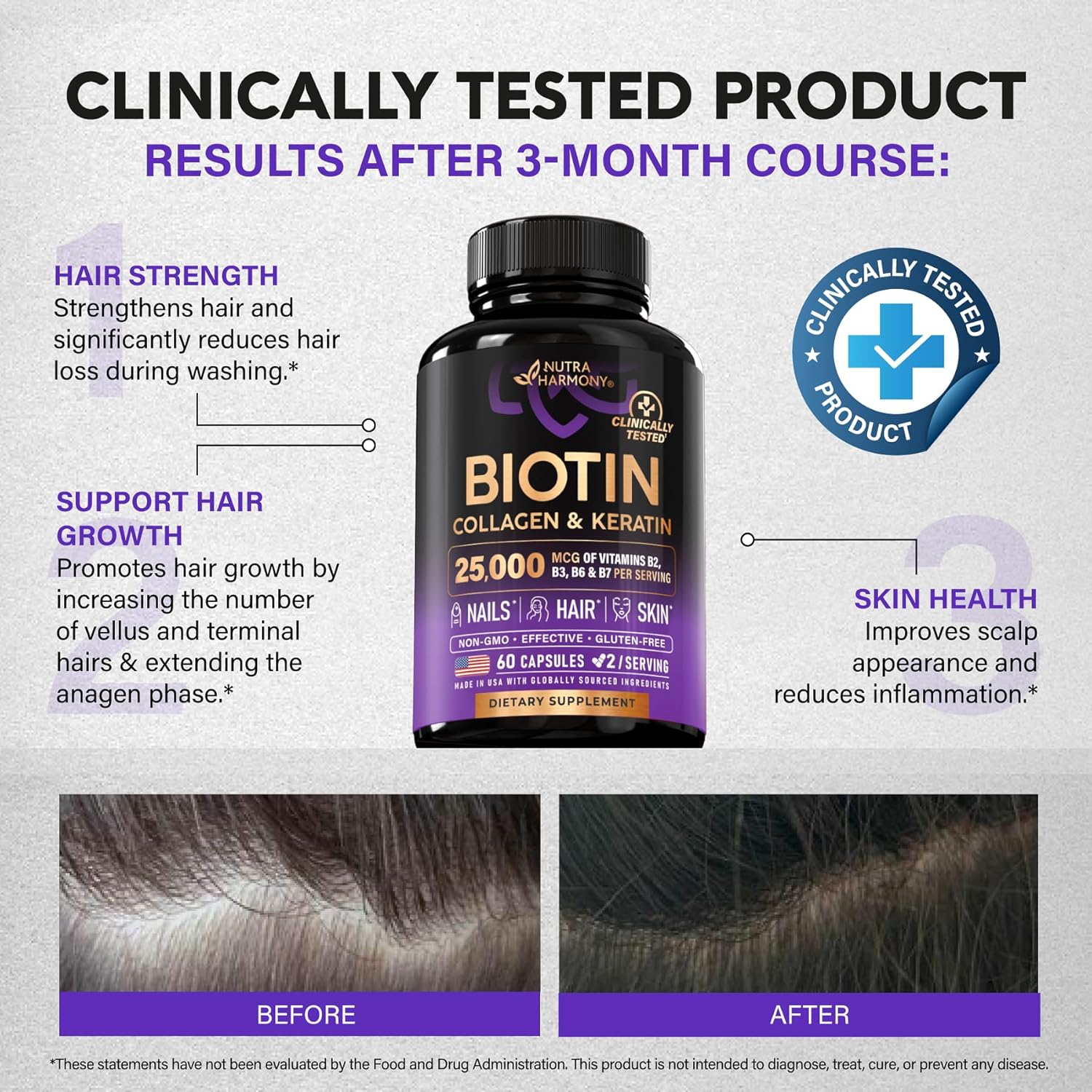 Biotin | Collagen | Keratin - Clinically Tested Supplement - Hair Growth Support, Skin & Nails - 25000 Mcg Vitamins B2, B3, B6 & B7 + B1 & Hyaluronic Acid - Made in USA - Women & Men | 60 Capsules